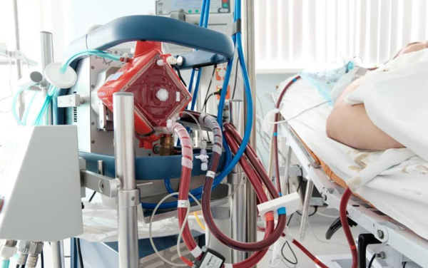 熱點 | 填補國產(chǎn)空白，ECMO迎來“中國造”